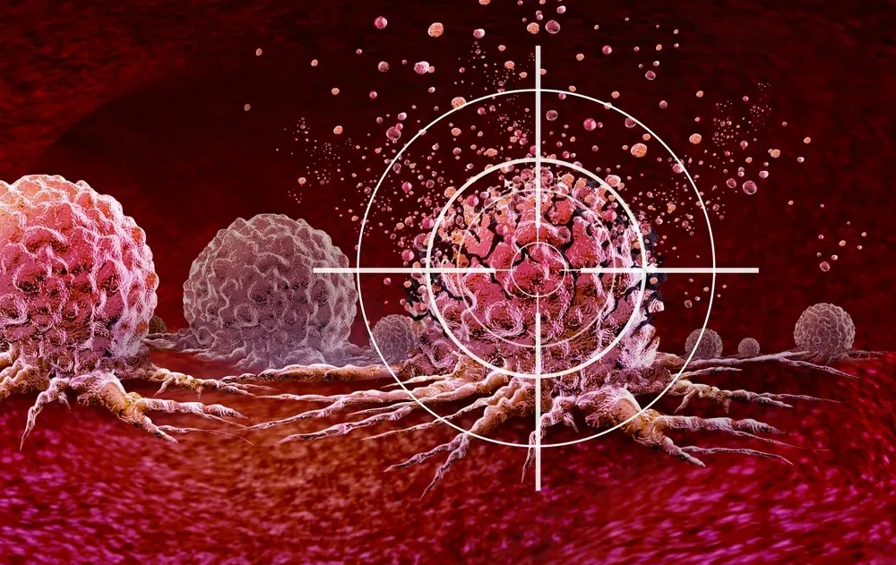 נס רפואי? טיפול חדשני הצליח להעלים סרטן אלים – גם אחרי 9 כשלונות נס רפואי? טיפול חדשני הצליח להעלים סרטן אלים – גם אחרי 9 כשלונות