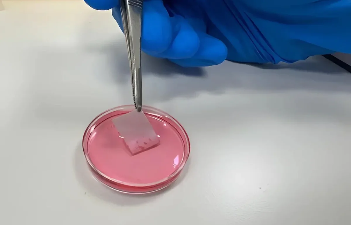 מדע החיים: מהפכה ישראלית בטיפול בכוויות &ndash; שתל עור מהונדס מתאי המטופל