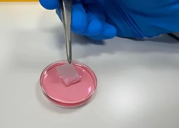 מדע החיים: מהפכה ישראלית בטיפול בכוויות &ndash; שתל עור מהונדס מתאי המטופל