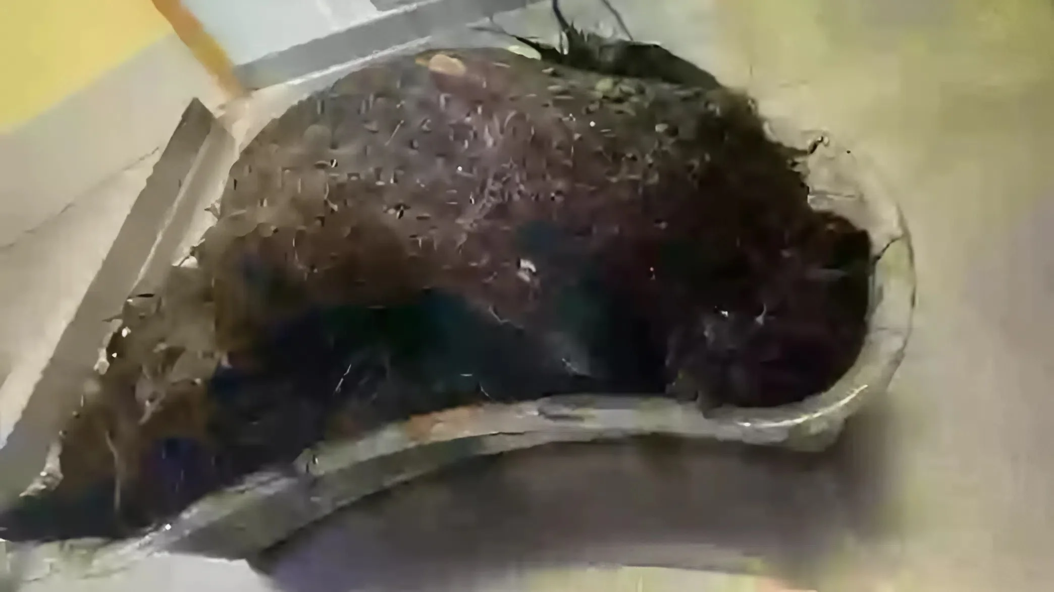 חצי שנה של כאבים: והרופאים מצאו בבטנה של נערה משהו בלתי נתפס