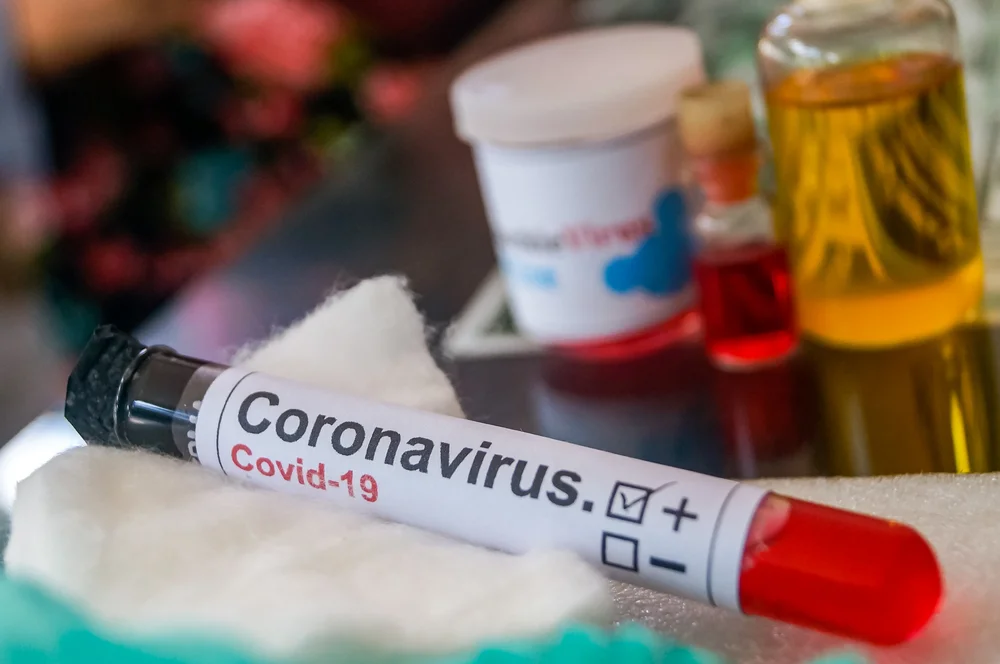 זן הקורונה "סטרטוס" התפשט לישראל: יותר חולים ותסמינים חריפים