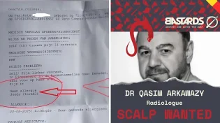 שערורייה רפואית בבלגיה: רופא רשם "יהודי ישראלי" כשדה אלרגיה בתיק רפואי של ילדה בת תשע