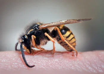 טרגדיה ברמת הגולן: גבר בן 42 מת מתגובה אלרגית לעקיצת צרעה