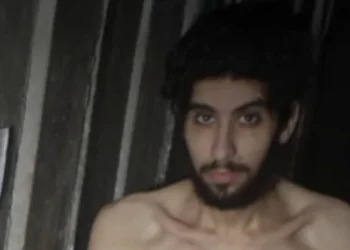 חשש רפואי: חמאס החל להאביס את החטופים לקראת שחרורם - בישראל מזהירים מפני סכנת "תסמונת ההזנה מחדש"