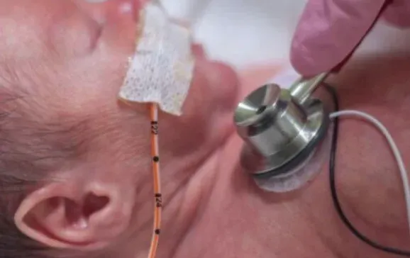 תינוק בן יומו כמעט מת בגלל משחה “תמימה” אחרי הברית