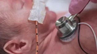 תינוק בן יומו כמעט מת בגלל משחה “תמימה” אחרי הברית