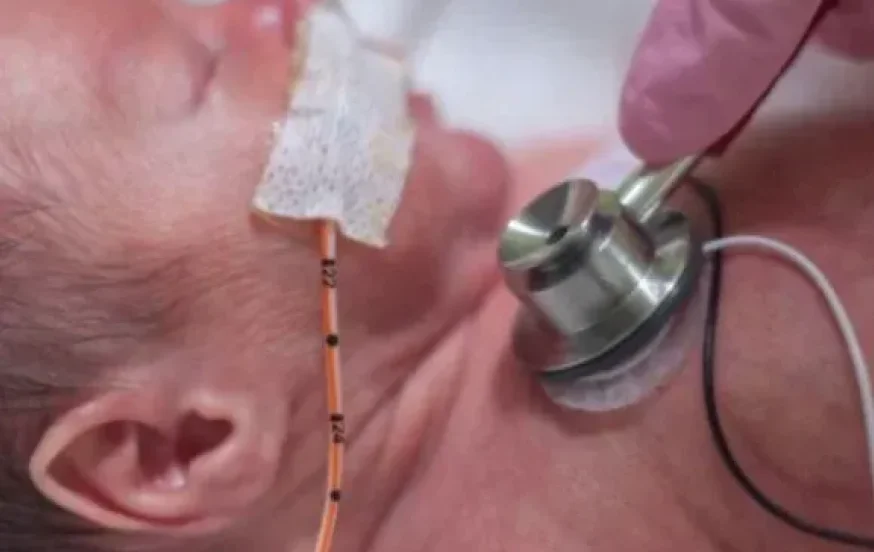 תינוק בן יומו כמעט מת בגלל משחה &ldquo;תמימה&rdquo; אחרי הברית