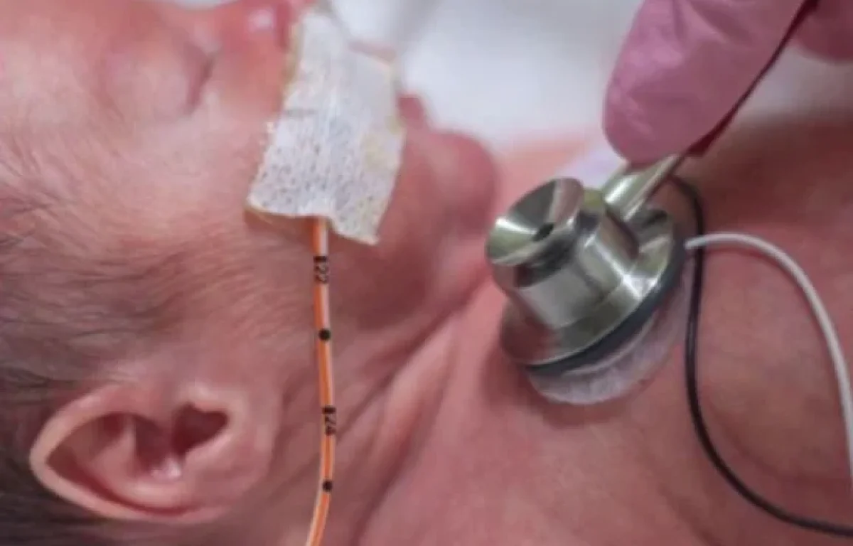 תינוק בן יומו כמעט מת בגלל משחה &ldquo;תמימה&rdquo; אחרי הברית