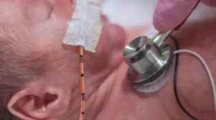 תינוק בן יומו כמעט מת בגלל משחה “תמימה” אחרי הברית