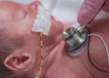 תינוק בן יומו כמעט מת בגלל משחה &ldquo;תמימה&rdquo; אחרי הברית