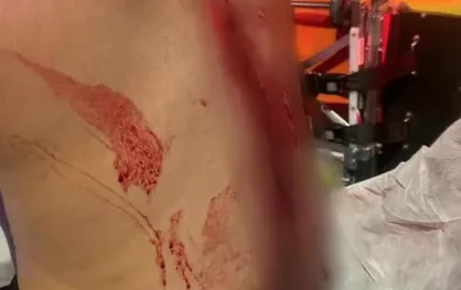 ארבעה נעצרו בחולון בחשד לשוד אלים של שליח מזון ארבעה נעצרו בחולון בחשד לשוד אלים של שליח מזון