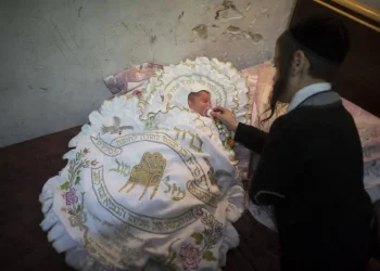 הרב שמשון פוקס: האם מותר לקרוא שם לפני הברית?