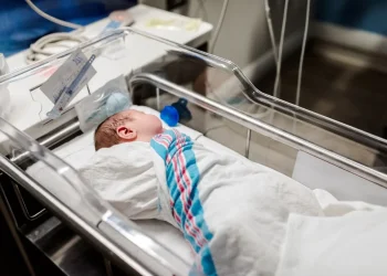 לידה חריגה באמריקה: נולדה תינוקת שלא יכולה לעצום עיניים