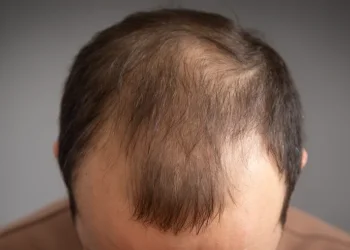 לא צריך תוספים: המאכלים שבאמת עוזרים נגד נשירת שיער