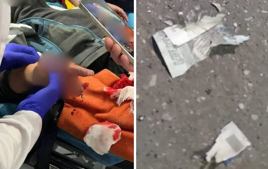 דרמה ברוסיה: שטר ממולכד התפוצץ בידיו של ילד 