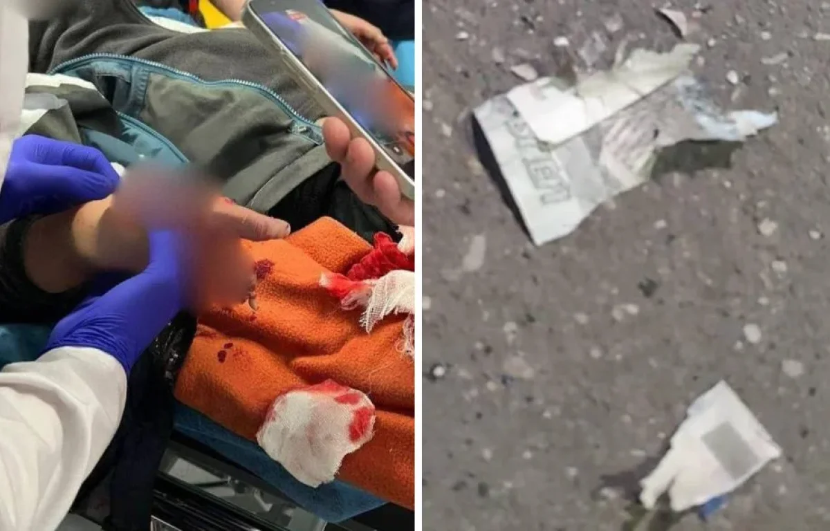 דרמה ברוסיה: שטר ממולכד התפוצץ בידיו של ילד 