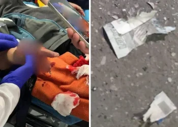 דרמה ברוסיה: שטר ממולכד התפוצץ בידיו של ילד 