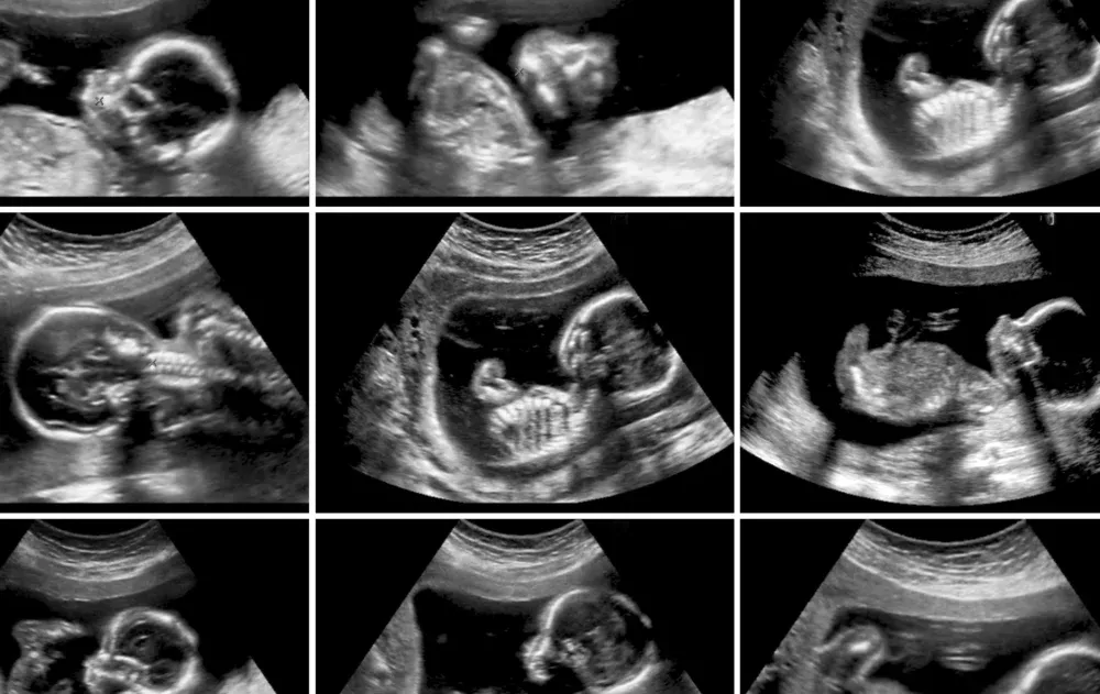 תשעה תינוקות בבת אחת: אישה במצרים הגיעה לבדיקה וזה מה שהיא גילתה