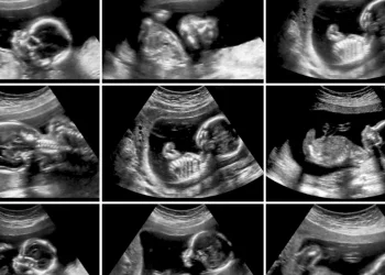 תשעה תינוקות בבת אחת: אישה במצרים הגיעה לבדיקה וזה מה שהיא גילתה