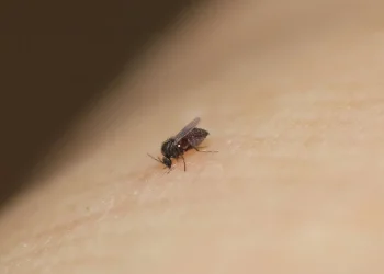המטבח נקי אבל מלא ברחשים? זה מה שאתם מפספסים