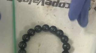 חשבו שמדובר בוירוס, אבל מה שהתגלה לפעוטה בבטן היה חריג