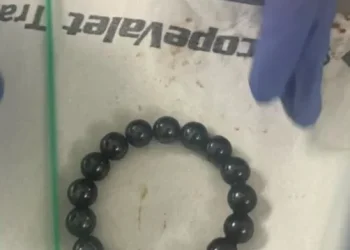 חשבו שמדובר בוירוס, אבל מה שהתגלה לפעוטה בבטן היה חריג חשבו שמדובר בוירוס, אבל מה שהתגלה לפעוטה בבטן היה חריג