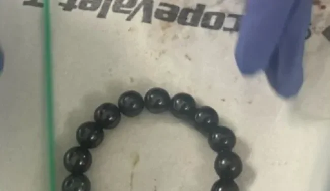חשבו שמדובר בוירוס, אבל מה שהתגלה לפעוטה בבטן היה חריג