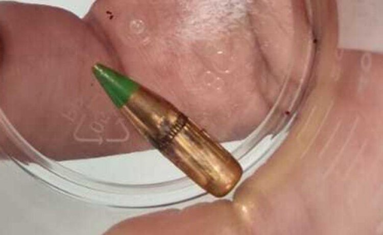 "ברוך ה' שנשארתי בחיים": תושב מעלות נורה בצוואר במהלך הליכה באגם הכדור שפגע בדביר. (צילום: דוברות המשטרה)